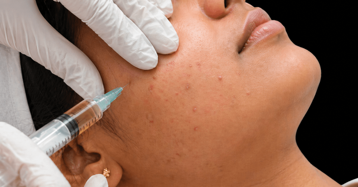 Best Dermatologist in Ghatkopar - Alana Clinic