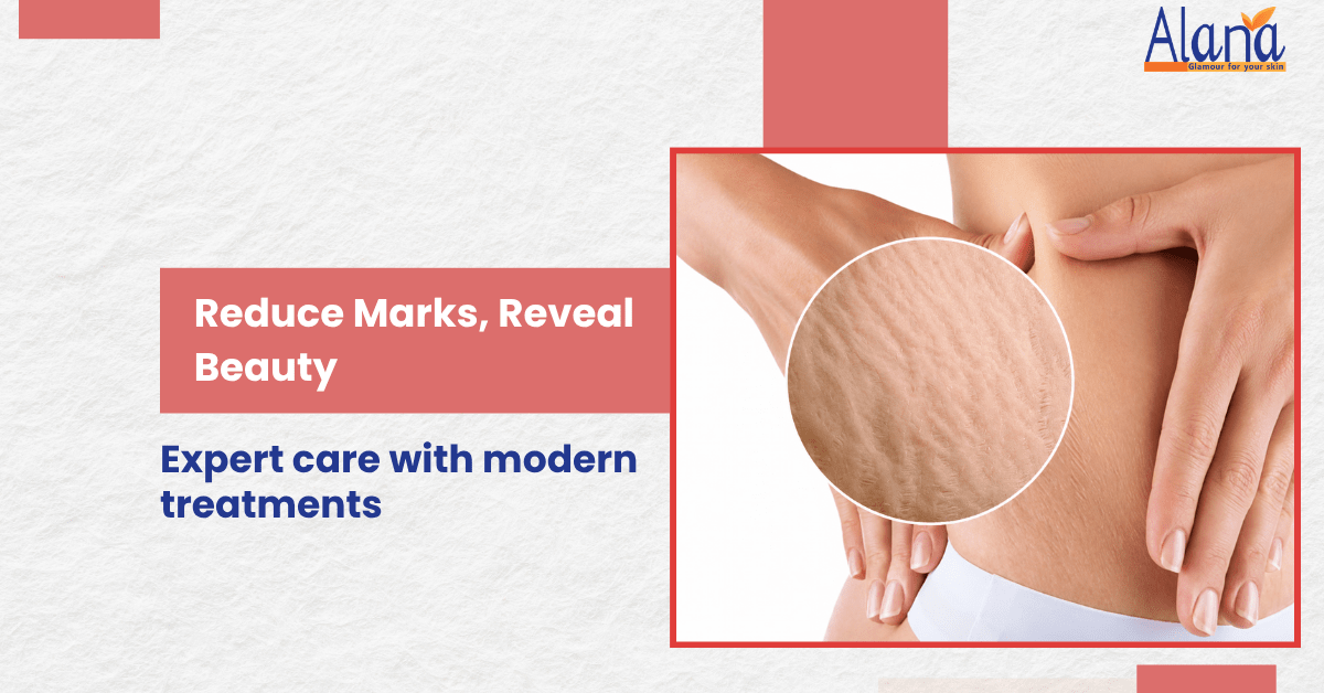 Effective Stretch Marks Treatment Options in Navi Mumbai